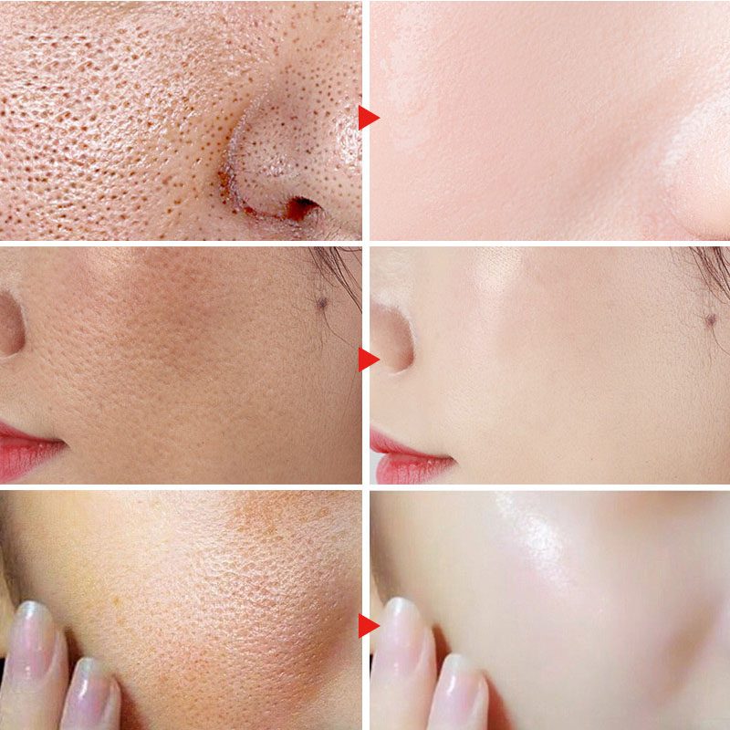 Lactobionic Acid Pore Shrink Face Serum Hyaluronic Acid Moisturizing Nourish Smooth Pores Repair Essence Firm Korean Cosmetics