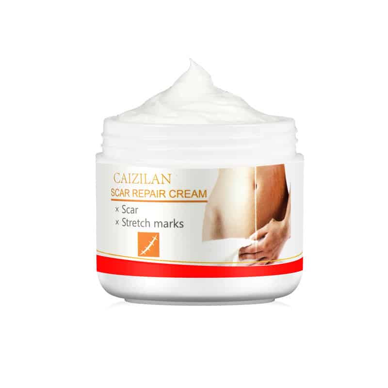 Pregnant Women Acne Scar Repair Cream Skin Care 30g